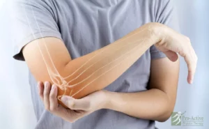 Ulnar Nerve Entrapments